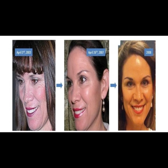 [NIB] Nuskin facial spa + conductive gel - Picture 3 of 9